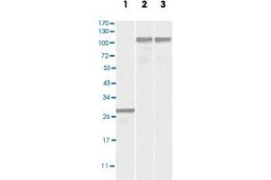 Western blot analysis using DNM2 monoclonal antibody, clone 5E4C2F3  against truncated DNM2 recombinant protein (Lane 1), SK-N-SH (Lane 2) and NIH/3T3 (Lane 3) cell lysates. (DNM2 抗体)