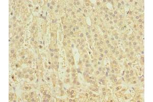 Immunohistochemistry of paraffin-embedded human adrenal gland tissue using  at dilution of 1:100 (CLEC4C 抗体  (AA 45-213))