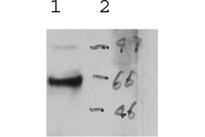 Perforin antibody detecting perforin day 3 rat kidney in glomerular nephritis (Perforin 1 抗体)