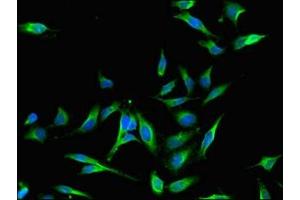 Immunofluorescent analysis of Hela cells using ABIN7159758 at dilution of 1:100 and Alexa Fluor 488-congugated AffiniPure Goat Anti-Rabbit IgG(H+L) (MAP4 抗体  (AA 575-818))
