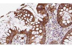 ABIN6272858 at 1/100 staining Mouse colon tissue by IHC-P. (IFT20 抗体)