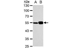 WB Image alpha Tubulin 1A antibody detects alpha Tubulin 1A protein by western blot analysis. (TUBA1A 抗体)