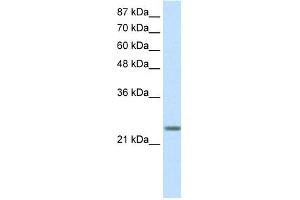 WB Suggested Anti-MXD3 Antibody Titration: 0. (MXD3 抗体  (N-Term))