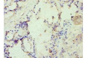 Immunohistochemistry (IHC) image for anti-Adaptor-Related Protein Complex 2, alpha 1 Subunit (AP2A1) (AA 1-260) antibody (ABIN7144361)
