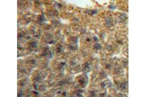 Used in DAB staining on fromalin fixed paraffin-embedded Liver tissue (IRF5 抗体  (AA 3-250))