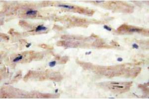 Immunohistochemistry (IHC) analyzes of Laminin alpha-4 antibody in paraffin-embedded human heart tissue. (LAMa4 抗体)
