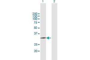 Western Blot analysis of ZCCHC9 expression in transfected 293T cell line by ZCCHC9 MaxPab polyclonal antibody. (ZCCHC9 抗体  (AA 1-271))