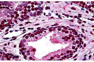 Human Prostate: Formalin-Fixed, Paraffin-Embedded (FFPE) (DLX2 抗体  (AA 1-110))