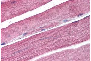 Human Skeletal Muscle (formalin-fixed, paraffin-embedded) stained with DCLRE1A antibody ABIN298128 at 2. (SNM1 抗体  (AA 397-410))