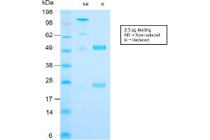 SDS-PAGE Analysis Purified Cytochrome C Recombinant Rabbit Monoclonal (CYCS/3128R). (Recombinant Cytochrome C 抗体)