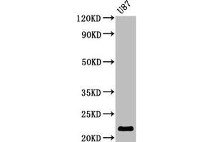 Western Blot Positive WB detected in: U87 whole cell lysate All lanes: AK1 antibody at 2. (Adenylate Kinase 1 抗体  (AA 1-194))
