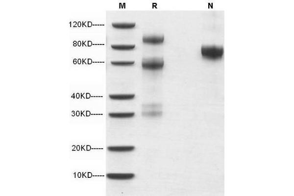 HGF Protein (AA 32-494, AA 495-728)