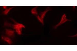 ABIN6275759 staining COLO205 by IF/ICC. (Cytochrome P450 11B1/2 抗体)