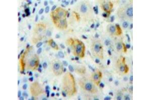 IHC-P analysis of Liver tissue, with DAB staining. (CD1d 抗体  (AA 56-271))
