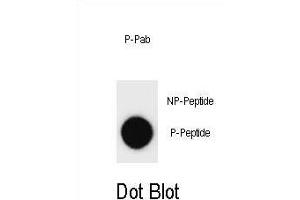 Dot blot analysis of Phospho-ERBB2- Antibody Phospho-specific Pab m on nitrocellulose membrane. (ErbB2/Her2 抗体  (pTyr877))