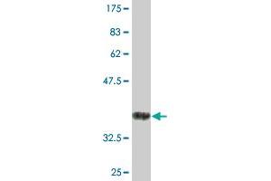Western Blot detection against Immunogen (36. (CD84 抗体  (AA 22-121))