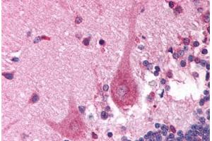 Human Brain, Cerebellum (formalin-fixed, paraffin-embedded) stained with PITX3 antibody ABIN214803 at 5 ug/ml followed by biotinylated goat anti-rabbit IgG secondary antibody ABIN481713, alkaline phosphatase-streptavidin and chromogen. (PITX3 抗体  (N-Term))