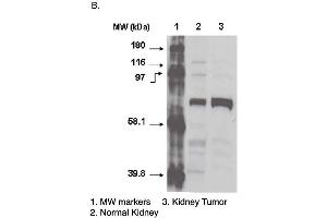 Western blot using CYP4F11 antibody one normal (2) and cancerous (3) kidney cell lysates. (CYP4F11 抗体  (C-Term))