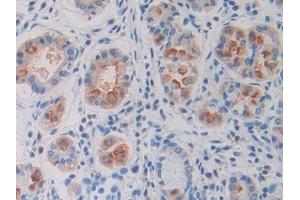 Immunohistochemistry (IHC) image for anti-Ornithine Decarboxylase 1 (ODC1) (AA 15-259) antibody (ABIN7433486)