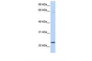 Image no. 1 for anti-ChaC, Cation Transport Regulator Homolog 1 (CHAC1) (AA 188-237) antibody (ABIN6738039)