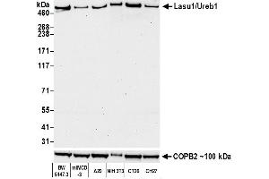 Western Blotting (WB) image for anti-HECT, UBA and WWE Domain Containing 1, E3 Ubiquitin Protein Ligase (HUWE1) (AA 2250-2300) antibody (ABIN7453974)