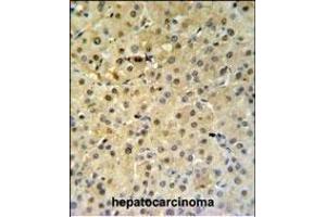 Immunohistochemistry (Paraffin-embedded Sections) (IHC (p)) image for anti-Proteasome (Prosome, Macropain) Activator Subunit 1 (PA28 Alpha) (PSME1) (AA 220-249), (C-Term) antibody (ABIN651448)