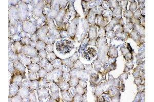 IHC analysis of CD105 using anti-CD105 antibody . (Endoglin 抗体  (AA 27-226))