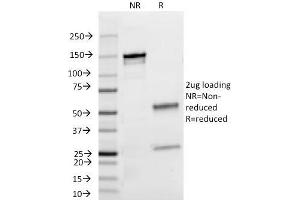 SDS-PAGE Analysis Purified Lambda Light Chain Mouse Monoclonal Antibody (HP6054). (IgL 抗体)