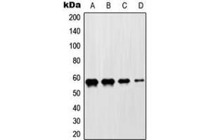Western blot analysis of ZNF682 expression in HeLa (A), Jurkat (B), NIH3T3 (C), H9C2 (D) whole cell lysates. (ZNF682 抗体  (N-Term))