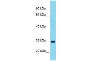 Host:  Rabbit  Target Name:  G3BP1  Sample Type:  Pancreas tumor lysates  Antibody Dilution:  1. (G3BP1 抗体  (N-Term))