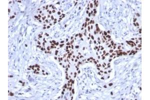 ABIN6383817 to TP53 was successfully used to stain human breast carcinoma sections.