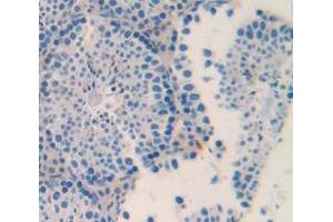 IHC-P analysis of Mouse Tissue, with DAB staining. (ACVR2A 抗体  (AA 326-485))