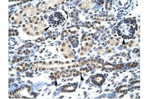 HTR3A antibody was used for immunohistochemistry at a concentration of 4-8 ug/ml to stain Epithelial cells of renal tubule (lndicated with Arrows] and renal corpuscle (Indicated with Arrow Heads) in Human Kidney. (Serotonin Receptor 3A 抗体  (N-Term))
