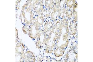 Immunohistochemistry of paraffin-embedded human stomach using AHCYL1 antibody at dilution of 1:100 (x40 lens). (AHCYL1 抗体)
