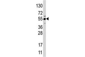 Western blot analysis of JMJD4 antibody and HepG2 lysate (JMJD4 抗体  (AA 1-30))