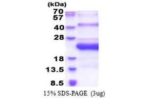SDS-PAGE (SDS) image for Sperm Mitochondria Associated Cysteine Rich Protein (SMCP) (AA 1-116) protein (His tag) (ABIN5853274) (SMCP Protein (AA 1-116) (His tag))
