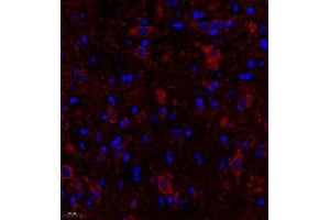 Immunofluorescence of paraffin embedded mouse spinal cord using FGF11 (ABIN7073941) at dilution of 1:2200 (400x lens) (FGF11 抗体)