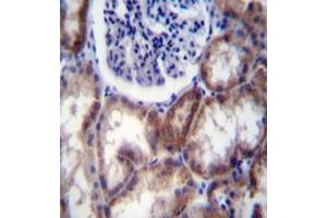 Immunohistochemistry analysis in formalin fixed and paraffin embedded human kidney tissue reacted with HYAL2 / Hyaluronidase-2 Antibody (Center) followed by peroxidase conjugation of the secondary antibody and DAB staining. (HYAL2 抗体  (Middle Region))