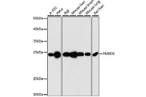 Western blot analysis of extracts of various cell lines, using TMED9 antibody (ABIN6293776) at 1:3000 dilution.