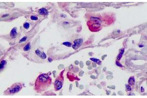 Human Lung: Formalin-Fixed, Paraffin-Embedded (FFPE) (Neurotrypsin 抗体  (N-Term))