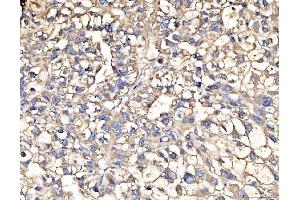 IHC analysis of AASS using anti-AASS antibody (ABIN7601519). (AASS 抗体  (AA 37-865))