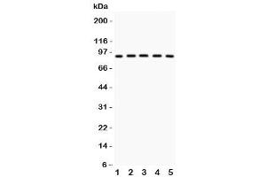 Western blot testing of Glucocorticoid receptor antibody and Lane 1:  HeLa