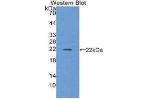 Western Blotting (WB) image for anti-CD40 (CD40) (AA 26-187) antibody (ABIN3206998) (CD40 抗体  (AA 26-187))