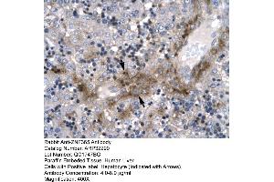 Immunohistochemistry (IHC) image for anti-Zinc Finger Protein 365 (ZNF365) (N-Term) antibody (ABIN2779545)