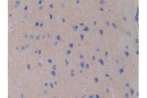 DAB staining on IHC-P; Samples: Mouse Cerebrum Tissue (FDFT1 抗体  (AA 217-416))