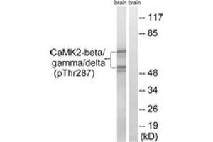 Western blot analysis of extracts from rat brain, using CaMK2-beta/gamma/delta (Phospho-Thr287) Antibody. (CaMK2 beta/gamma/delta (AA 253-302), (pThr287) 抗体)