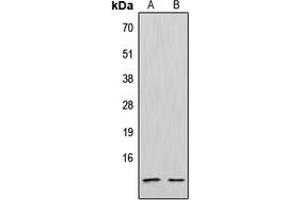 Western blot analysis of CXCL12 expression in Jurkat (A), NCIH292 (B) whole cell lysates. (CXCL12 抗体  (C-Term))