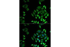 Immunofluorescence analysis of U2OS cells using PLG2D antibody (ABIN6132162, ABIN6145727, ABIN6145729 and ABIN6222983). (PLA2G2D 抗体  (AA 21-145))