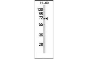Western blot analysis of GBE1 Antibody (Center) in HL-60 cell line lysates (35ug/lane). (GBE1 抗体  (Middle Region))