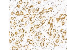 Immunohistochemistry (IHC) image for anti-Sp1 Transcription Factor (SP1) (AA 250-300) antibody (ABIN7795788) (Recombinant SP1 抗体  (AA 250-300))